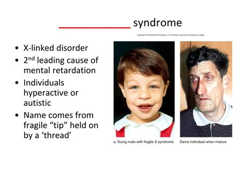 Ppt • Chromosomal Inheritance Human X Linked Disorders Gene Linkage