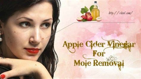 4 ways on how to apple cider vinegar for mole removal on face