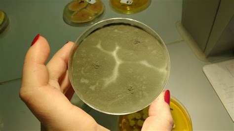 aspergillus flavus sabouraud  plate fungi microbiology plates