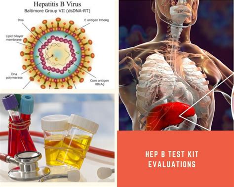 Pin On Hepatitis B Test Kits