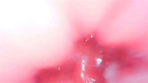 anal hole inside endoscope view filled with cum 11 04 2020