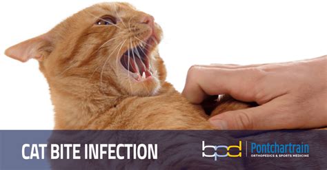cat bite infection risk  cat bite   hand brandon p donnelly md