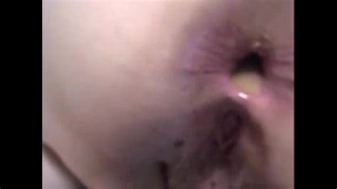 Son Give Mom Painful Anal Sex And A Anal Creampie