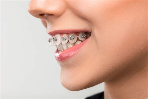 ciri ciri gigi  bisa  tidak bisa dibehel  sehat