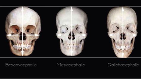 dolichocephalic alien skulls looksmaxorg mens  improvement aesthetics