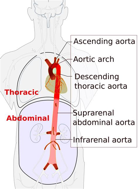 aortic dissection explained risk factors symptoms diagnosis faqs