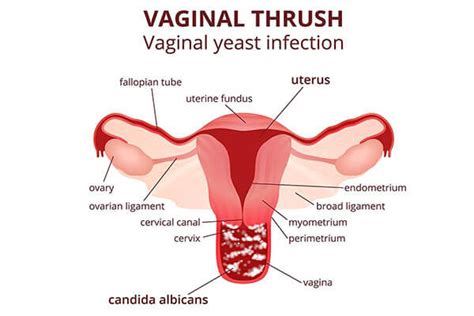 dry vaginal skin detailed knowledge about the treatment