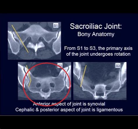 sacroiliac joint anatomy function  interventions