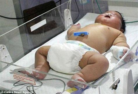 چاق ترین کودک دنیا در هند به دنیا آمد عکس