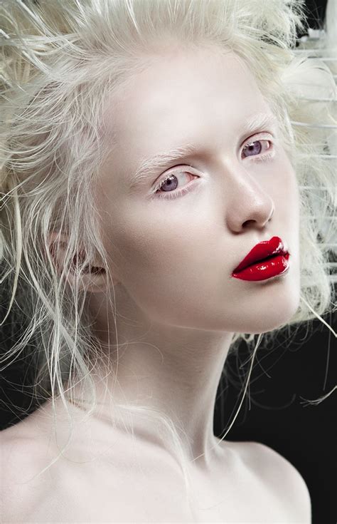 Albino Human Modelo Albino Portraiture Portrait Photography Showman