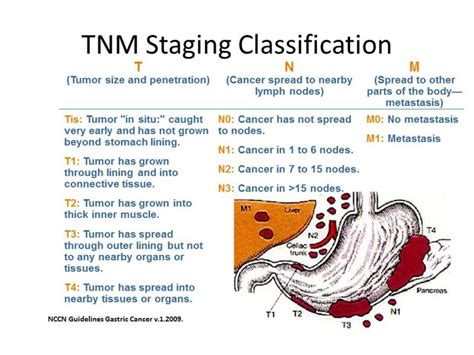 Gastric Cancer Cancer Therapy Advisor