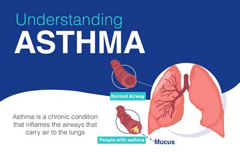 overview  asthma  symptomstypes risk factors   treatment