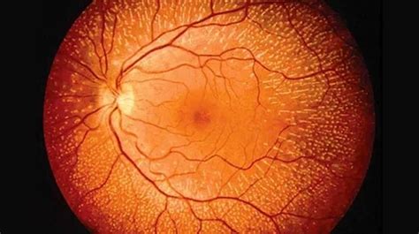 importance  examining  retina today posting