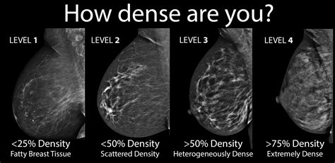 breast density how to see clearly through the fog huffpost life