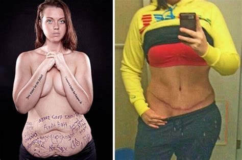 Hot Brunette Unrecognisable After 10st Weight Loss And Tummy Tuck
