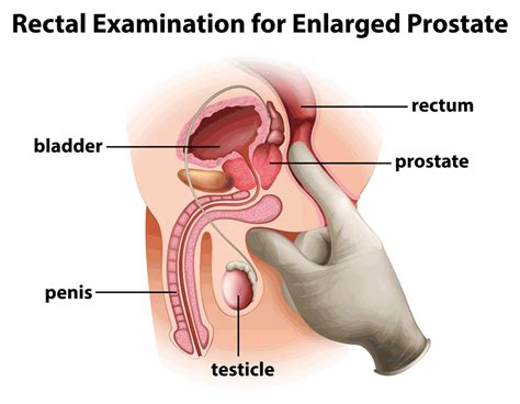 prostate massage by britney