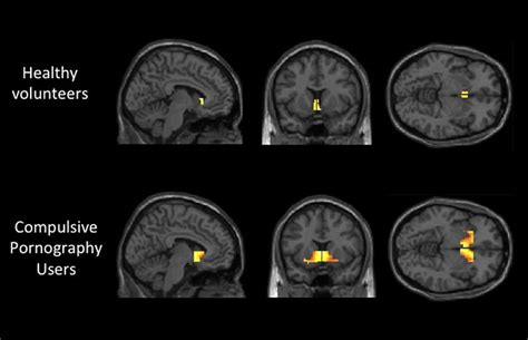 porn addiction shows up on brain scans women of grace
