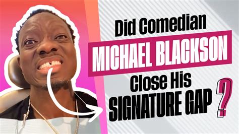 did comedian michael blackson close his signature gap