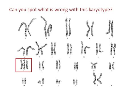 ppt chromosomal disorders powerpoint presentation free download id