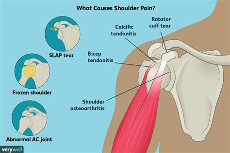 anatomy   human shoulder joint