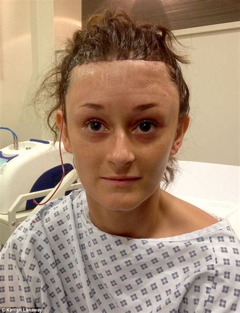 kent woman bullied for large forehead got £6 500 surgery daily mail