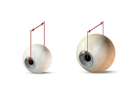 eye size comparison artwork photograph  claus lunau fine art america