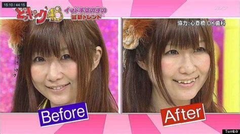 yaeba japanese double tooth trend will give you a costly crooked smile pictures huffpost uk