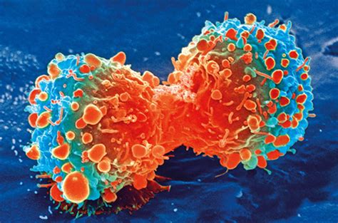 tumor promoting immune cells retrained  fight  aggressive type