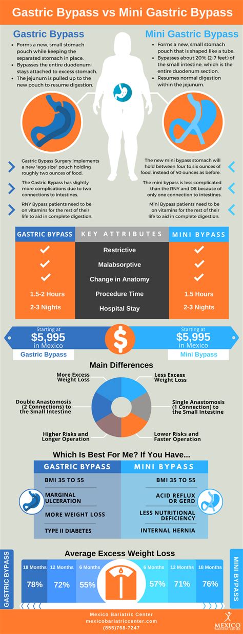 Gastric Bypass Vs Mini Gastric Bypass Comparison Infographic
