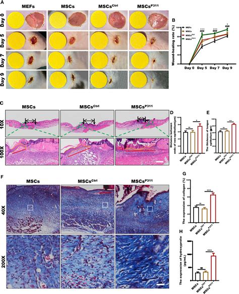 frontiers p facilitates  angiogenesis  wound healing