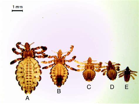 Haematopinus Tuberculatus At Different Stages A Female B Male C