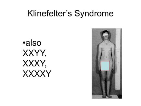 Klinefelter S Syndrome Screen 4 On Flowvella Presenta