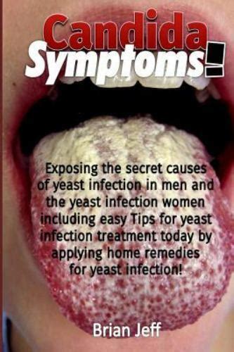 candida symptoms exposing the secret causes of yeast infection in