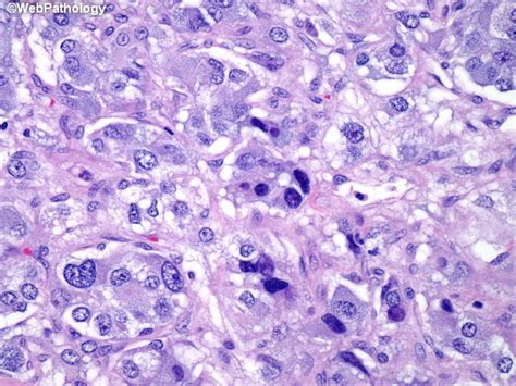 a collection of surgical pathology images