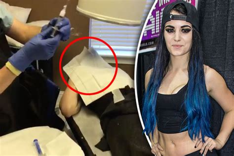 Wwe Diva Paige Seeks Medical Help For Injury After Sex
