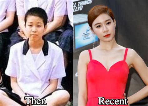 Yoo In Na Plastic Surgery Before And After Photos