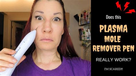 plasma mole remover pen review and demo i does it really remove freckles