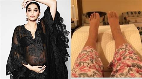 sonam kapoor shares picture  swollen feet pregnancy   pretty