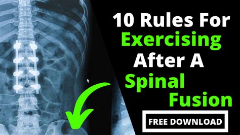 The Do S And Don Ts Of Exercising After A Spinal Fusion