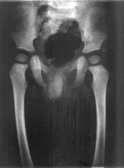 x ray of penis in anus cumception