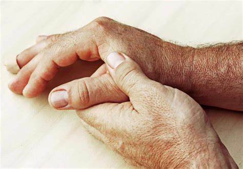 rheumatoid arthritis treatment  ayurveda