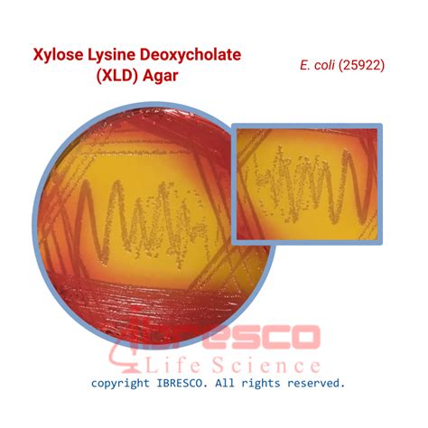 xylose lysine deoxycholate xld  ibresco