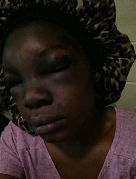 pregnant tennessee woman miscarries after brutal beating daily mail