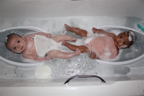 Unique Twins Born With Different Skin Colours At Nottingham City