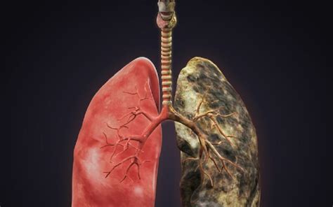 symptoms  lung cancer rustoto