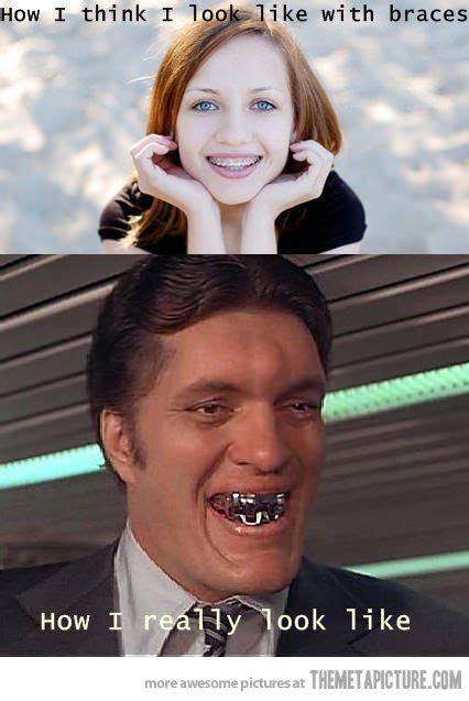 braces humor braces and this is me on pinterest