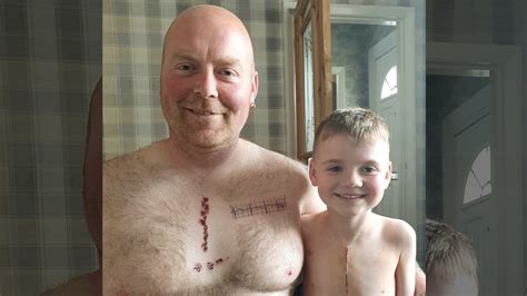 dad gets tattoo to match son s heart surgery scar inside