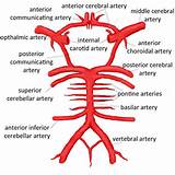 Carotid Artery Flow