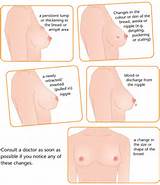 Pictures of Diagnosis Test For Breast Cancer