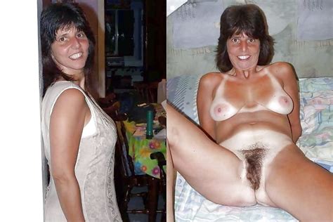 Dressed Undressed Vol 234 Hairy Special 62 Pics
